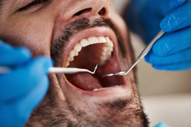 Professional Emergency Dental Service in IL