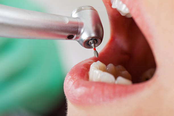 Best Weekend Emergency Dental Services in Streamwood, IL